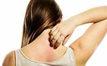 गर्मी में घमौरियों से होने वाली जलन और खुजली से हैं परेशान, ये नुस्खे देंगे आराम