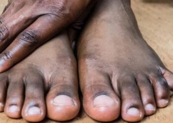 पैरों के कालेपन से अब नहीं होगी शर्मिंदगी…ट्राई करें ये 5 घरेलू नुस्खे