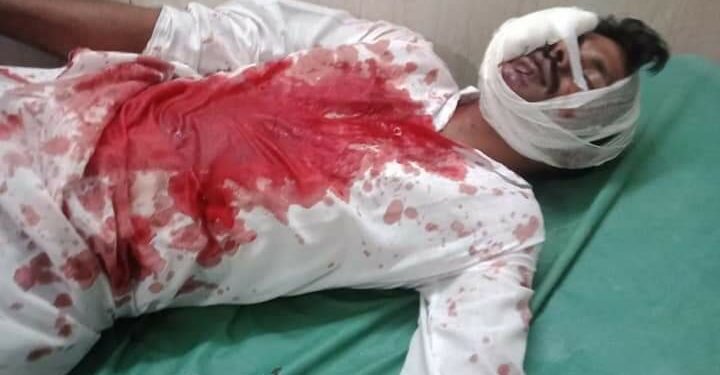 गोसाईगंज में अधेड़ पर बांके से हमला कर किया लहूलुहान