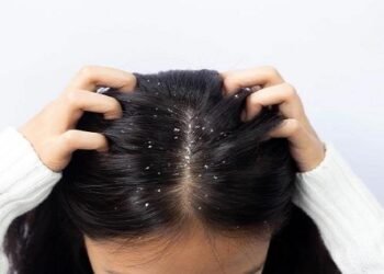 डैंड्रफ से निजात दिला सकती हैं ये 3 चीज़ें,जानें इस्तेमाल का तरीका