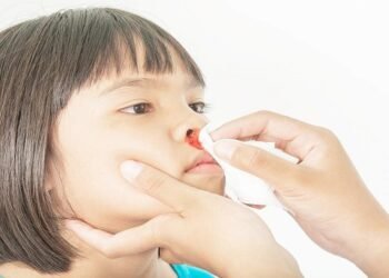 गर्मियों में नकसीर या नाक से खून आने की समस्या से छुटकारा दिलाएंगे से 10 घरेलू नुस्खे, इस तरह करें प्रयोग