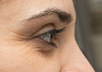 आपकी ये 6 आदतें बढ़ा सकती है आंखो के आसपास के रिंकल्स