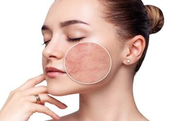 Skin Care Tips: मानसून में कैसे करें सेंसिटिव स्किन की देखभाल, जानें कुछ टिप्स