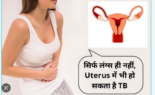 Tuberculosis also occurs in uterus, know its symptoms, causes and treatment