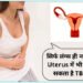 Tuberculosis also occurs in uterus, know its symptoms, causes and treatment
