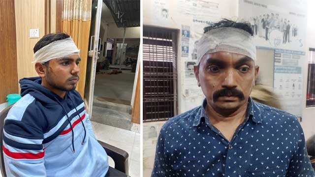 Chandauli: शराब पीने से मना करने पर शराबियों ने व्यापार मंडल महामंत्री समेत 4 को पीटा