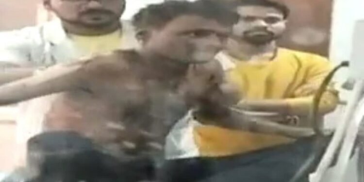 मुख्यमंत्री आवास के सामने पीड़ित ने आग लगा कर आत्मदाह करने का किया प्रयास
