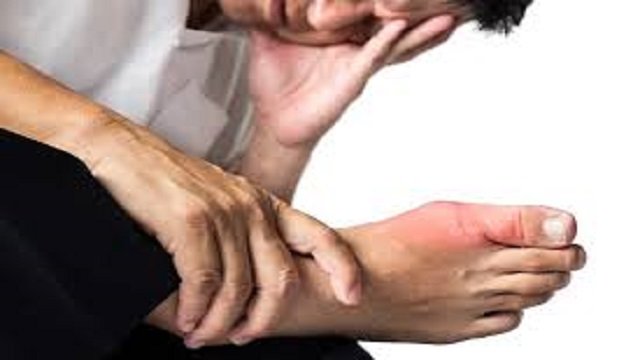 बढ़े हुए Uric Acid को कंट्रोल के लिए अपनाऐ ये 5 आयुर्वेदिक उपाय
