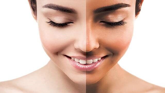 धूप आपकी त्वाचा के कालेपन का कारण है ? तो आज ही ट्राई करें ये होममेड 5 डी-टैन फेस पैक