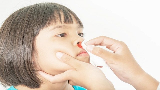 गर्मियों में नकसीर या नाक से खून आने की समस्या से छुटकारा दिलाएंगे से 10 घरेलू नुस्खे, इस तरह करें प्रयोग