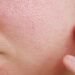 चेहरे के छोटे-बड़े स्किन पोर्स (Skin Pores) को छुपाने के लिये अपनायें 3-स्टेप मेकअप रूटीन