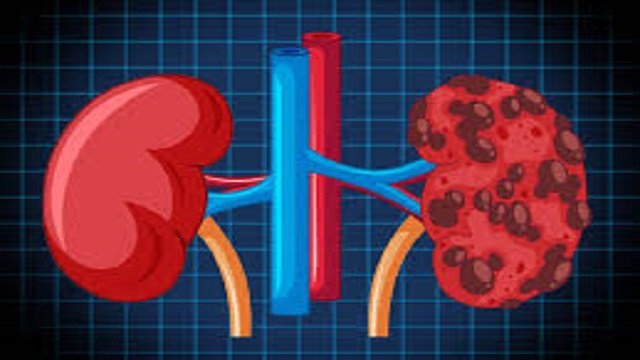 kidney Disease : किडनी की बीमारी से है परेशान तो बना लीजिए इन 5 हेल्दी फूड्स को अपना बेस्टि फ्रेंड