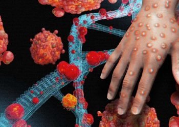 Monkeypox Virus