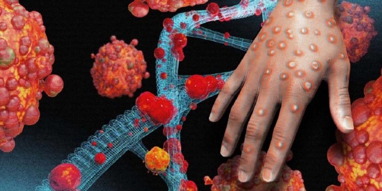 Monkeypox Virus